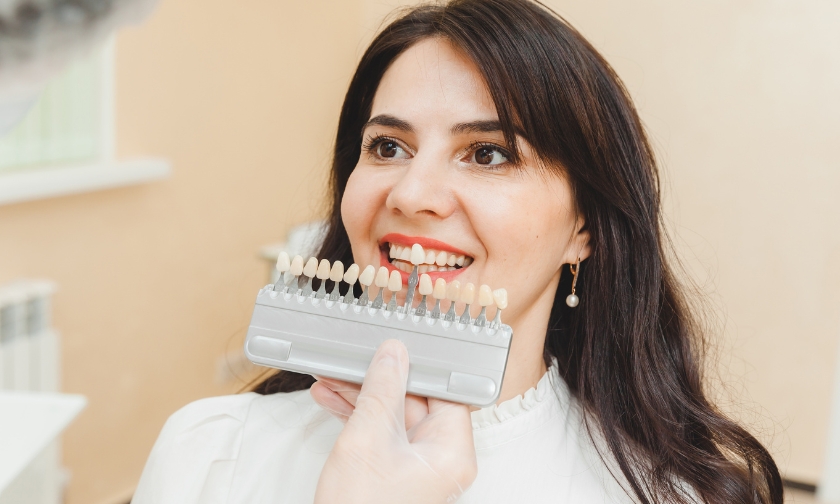 fix stubborn stains with veneers in sugar land